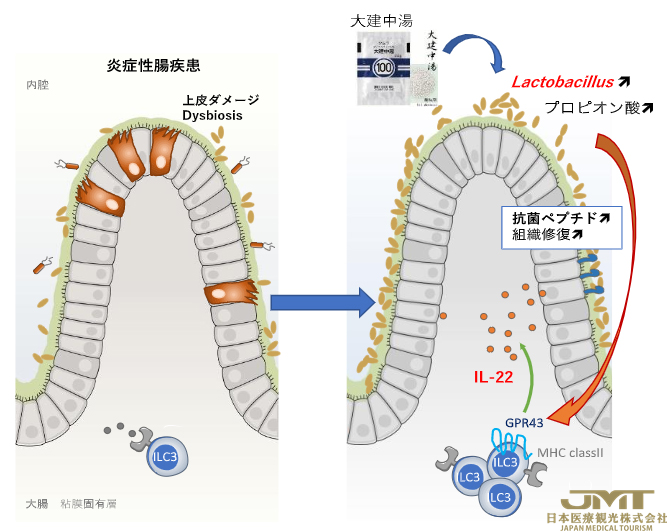 JMT日本医疗——阐明汉方药“大建中汤”在炎症性肠病中的作用机制②