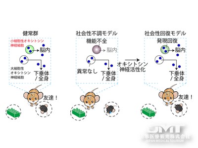 JMT日本医疗——催产素神经元功能障碍与自闭症谱系障碍等社交障碍有关