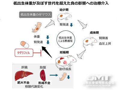 JMT日本医疗——使用动物模型阐明低出生体重对各代的负面影响机制