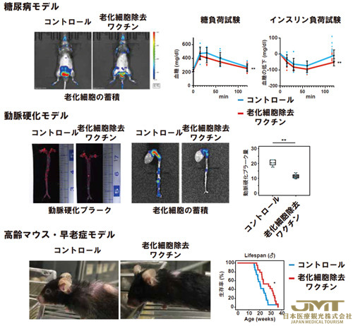 JMT日本医疗——顺天堂大学成功研发出消除老化细胞的疫苗，有望用于阿尔茨海默症的治疗