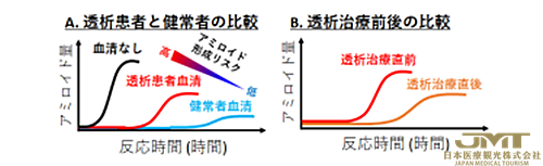 JMT日本医疗——日本发现透析淀粉样变性的新危险因素