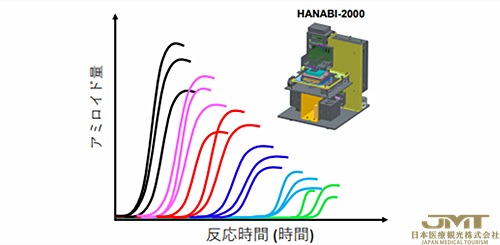 JMT日本医疗——日本发现透析淀粉样变性的新危险因素