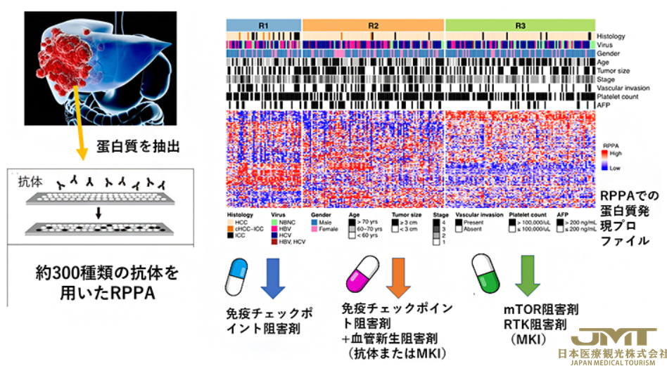 JMT日本医疗——肝癌的分子分类与治疗药物选择②